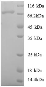 SDS-PAGE separation of QP7075 followed by commassie total protein stain results in a primary band consistent with reported data for DNA ligase. These data demonstrate Greater than 90% as determined by SDS-PAGE.