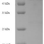 SDS-PAGE separation of QP7119 followed by commassie total protein stain results in a primary band consistent with reported data for Beta-lactamase. These data demonstrate Greater than 90% as determined by SDS-PAGE.