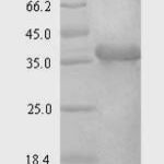 SDS-PAGE separation of QP7123 followed by commassie total protein stain results in a primary band consistent with reported data for Syndecan-4 / SDC4. These data demonstrate Greater than 90% as determined by SDS-PAGE.