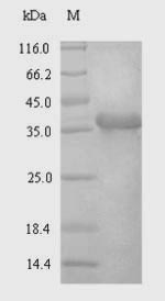 SDS-PAGE separation of QP7123 followed by commassie total protein stain results in a primary band consistent with reported data for Syndecan-4 / SDC4. These data demonstrate Greater than 90% as determined by SDS-PAGE.