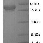 SDS-PAGE separation of QP7131 followed by commassie total protein stain results in a primary band consistent with reported data for CFA / I fimbrial subunit E. These data demonstrate Greater than 80% as determined by SDS-PAGE.