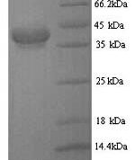 SDS-PAGE separation of QP7131 followed by commassie total protein stain results in a primary band consistent with reported data for CFA / I fimbrial subunit E. These data demonstrate Greater than 80% as determined by SDS-PAGE.