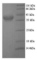 SDS-PAGE separation of QP7131 followed by commassie total protein stain results in a primary band consistent with reported data for CFA / I fimbrial subunit E. These data demonstrate Greater than 80% as determined by SDS-PAGE.