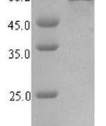 SDS-PAGE separation of QP7139 followed by commassie total protein stain results in a primary band consistent with reported data for Uncharacterized protein YihF. These data demonstrate Greater than 90% as determined by SDS-PAGE.