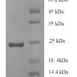 SDS-PAGE separation of QP7155 followed by commassie total protein stain results in a primary band consistent with reported data for Spike glycoprotein. These data demonstrate Greater than 90% as determined by SDS-PAGE.