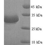 SDS-PAGE separation of QP7160 followed by commassie total protein stain results in a primary band consistent with reported data for Beta-lactamase CTX-M-1. These data demonstrate Greater than 90% as determined by SDS-PAGE.