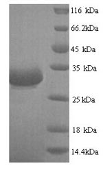 SDS-PAGE separation of QP7160 followed by commassie total protein stain results in a primary band consistent with reported data for Beta-lactamase CTX-M-1. These data demonstrate Greater than 90% as determined by SDS-PAGE.