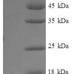 SDS-PAGE separation of QP7172 followed by commassie total protein stain results in a primary band consistent with reported data for IFM1