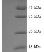 SDS-PAGE separation of QP7172 followed by commassie total protein stain results in a primary band consistent with reported data for IFM1