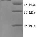 SDS-PAGE separation of QP7178 followed by commassie total protein stain results in a primary band consistent with reported data for Spike glycoprotein. These data demonstrate Greater than 90% as determined by SDS-PAGE.