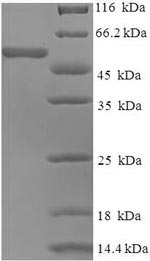 SDS-PAGE separation of QP7178 followed by commassie total protein stain results in a primary band consistent with reported data for Spike glycoprotein. These data demonstrate Greater than 90% as determined by SDS-PAGE.