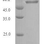 SDS-PAGE separation of QP7192 followed by commassie total protein stain results in a primary band consistent with reported data for Gingipain R1. These data demonstrate Greater than 80% as determined by SDS-PAGE.