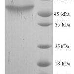 SDS-PAGE separation of QP7203 followed by commassie total protein stain results in a primary band consistent with reported data for Cytosine deaminase. These data demonstrate Greater than 90% as determined by SDS-PAGE.