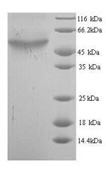 SDS-PAGE separation of QP7203 followed by commassie total protein stain results in a primary band consistent with reported data for Cytosine deaminase. These data demonstrate Greater than 90% as determined by SDS-PAGE.