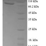 SDS-PAGE separation of QP7207 followed by commassie total protein stain results in a primary band consistent with reported data for Transketolase 1. These data demonstrate Greater than 90% as determined by SDS-PAGE.