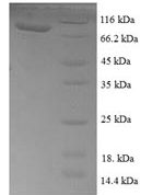 SDS-PAGE separation of QP7207 followed by commassie total protein stain results in a primary band consistent with reported data for Transketolase 1. These data demonstrate Greater than 90% as determined by SDS-PAGE.