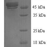 SDS-PAGE separation of QP7209 followed by commassie total protein stain results in a primary band consistent with reported data for Botulinum neurotoxin type F. These data demonstrate Greater than 90% as determined by SDS-PAGE.