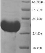 SDS-PAGE separation of QP7221 followed by commassie total protein stain results in a primary band consistent with reported data for Thyroxine 5-deiodinase. These data demonstrate Greater than 90% as determined by SDS-PAGE.