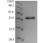 SDS-PAGE separation of QP7239 followed by commassie total protein stain results in a primary band consistent with reported data for CS6 fimbrial subunit B. These data demonstrate Greater than 92.2% as determined by SDS-PAGE.