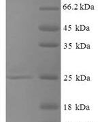 SDS-PAGE separation of QP7250 followed by commassie total protein stain results in a primary band consistent with reported data for Selenoprotein T. These data demonstrate Greater than 90% as determined by SDS-PAGE.