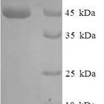 SDS-PAGE separation of QP7256 followed by commassie total protein stain results in a primary band consistent with reported data for Beta-lactamase TEM. These data demonstrate Greater than 90% as determined by SDS-PAGE.