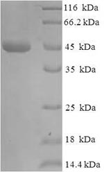 SDS-PAGE separation of QP7256 followed by commassie total protein stain results in a primary band consistent with reported data for Beta-lactamase TEM. These data demonstrate Greater than 90% as determined by SDS-PAGE.