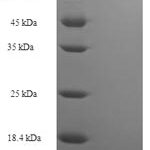 SDS-PAGE separation of QP7262 followed by commassie total protein stain results in a primary band consistent with reported data for nrdA. These data demonstrate Greater than 90% as determined by SDS-PAGE.