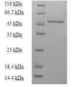SDS-PAGE separation of QP7263 followed by commassie total protein stain results in a primary band consistent with reported data for Purine nucleoside phosphorylase / PNP. These data demonstrate Greater than 90% as determined by SDS-PAGE.
