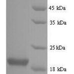 SDS-PAGE separation of QP7284 followed by commassie total protein stain results in a primary band consistent with reported data for Influenza B (strain B / Singapore / 222 / 1979) Nucleoprotein. These data demonstrate Greater than 90% as determined by SDS-PAGE.