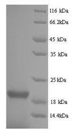 SDS-PAGE separation of QP7284 followed by commassie total protein stain results in a primary band consistent with reported data for Influenza B (strain B / Singapore / 222 / 1979) Nucleoprotein. These data demonstrate Greater than 90% as determined by SDS-PAGE.