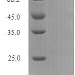 SDS-PAGE separation of QP7285 followed by commassie total protein stain results in a primary band consistent with reported data for Influenza B (strain B / Singapore / 222 / 1979) Nucleoprotein. These data demonstrate Greater than 90% as determined by SDS-PAGE.