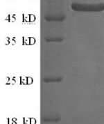 SDS-PAGE separation of QP7286 followed by commassie total protein stain results in a primary band consistent with reported data for Alpha-galactosidase 1. These data demonstrate Greater than 90% as determined by SDS-PAGE.