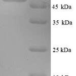 SDS-PAGE separation of QP7293 followed by commassie total protein stain results in a primary band consistent with reported data for Minor capsid protein L2. These data demonstrate Greater than 90% as determined by SDS-PAGE.