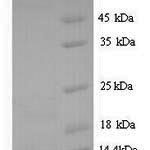 SDS-PAGE separation of QP7305 followed by commassie total protein stain results in a primary band consistent with reported data for Shiga-like toxin 2 subunit B. These data demonstrate Greater than 94.5% as determined by SDS-PAGE.