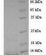 SDS-PAGE separation of QP7305 followed by commassie total protein stain results in a primary band consistent with reported data for Shiga-like toxin 2 subunit B. These data demonstrate Greater than 94.5% as determined by SDS-PAGE.