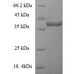 SDS-PAGE separation of QP7311 followed by commassie total protein stain results in a primary band consistent with reported data for Enterotoxin type G. These data demonstrate Greater than 90% as determined by SDS-PAGE.