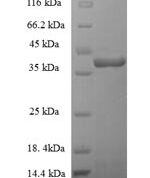 SDS-PAGE separation of QP7311 followed by commassie total protein stain results in a primary band consistent with reported data for Enterotoxin type G. These data demonstrate Greater than 90% as determined by SDS-PAGE.