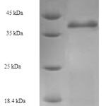 SDS-PAGE separation of QP7321 followed by commassie total protein stain results in a primary band consistent with reported data for ruvA. These data demonstrate Greater than 90% as determined by SDS-PAGE.