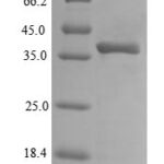 SDS-PAGE separation of QP7322 followed by commassie total protein stain results in a primary band consistent with reported data for Outer membrane protein A. These data demonstrate Greater than 90% as determined by SDS-PAGE.