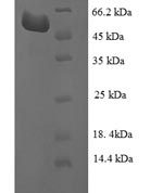 SDS-PAGE separation of QP7324 followed by commassie total protein stain results in a primary band consistent with reported data for Glutamate-pyruvate aminotransferase AlaA. These data demonstrate Greater than 90% as determined by SDS-PAGE.