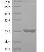 SDS-PAGE separation of QP7341 followed by commassie total protein stain results in a primary band consistent with reported data for GTP-binding protein YPT1. These data demonstrate Greater than 90% as determined by SDS-PAGE.