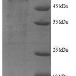 SDS-PAGE separation of QP7356 followed by commassie total protein stain results in a primary band consistent with reported data for HIV-1 (group M