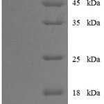 SDS-PAGE separation of QP7357 followed by commassie total protein stain results in a primary band consistent with reported data for Influenza B (strain B / Lee / 1940) Nucleoprotein. These data demonstrate Greater than 90% as determined by SDS-PAGE.