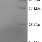 SDS-PAGE separation of QP7359 followed by commassie total protein stain results in a primary band consistent with reported data for Serum amyloid A-3 protein. These data demonstrate Greater than 80% as determined by SDS-PAGE.