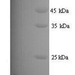 SDS-PAGE separation of QP7360 followed by commassie total protein stain results in a primary band consistent with reported data for Major urinary protein 11. These data demonstrate Greater than 81.5% as determined by SDS-PAGE.