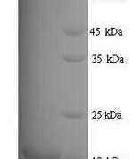SDS-PAGE separation of QP7360 followed by commassie total protein stain results in a primary band consistent with reported data for Major urinary protein 11. These data demonstrate Greater than 81.5% as determined by SDS-PAGE.