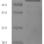 SDS-PAGE separation of QP7362 followed by commassie total protein stain results in a primary band consistent with reported data for Porin P. These data demonstrate Greater than 90% as determined by SDS-PAGE.