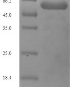 SDS-PAGE separation of QP7362 followed by commassie total protein stain results in a primary band consistent with reported data for Porin P. These data demonstrate Greater than 90% as determined by SDS-PAGE.