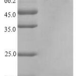 SDS-PAGE separation of QP7364 followed by commassie total protein stain results in a primary band consistent with reported data for Carboxypeptidase G2. These data demonstrate Greater than 90% as determined by SDS-PAGE.