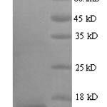 SDS-PAGE separation of QP7367 followed by commassie total protein stain results in a primary band consistent with reported data for Protein E7. These data demonstrate Greater than 90% as determined by SDS-PAGE.